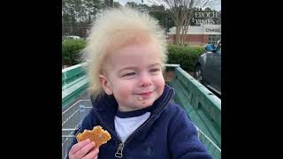 Boy With Rare Uncombable Hair Syndrome Brings a Smile to Faces [upl. by Sokem]