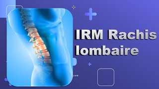 IRM du Rachis lombaire Bonne Pratique [upl. by Ayotan]