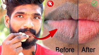 Dark To Pink Lips In 1 MINUTE  5 Best Home remedies   தமிழ் [upl. by Etterual]