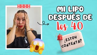 Mi experiencia lipoescultura después de los 40 años [upl. by Nance71]