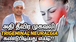 TRIGEMINAL NEURALGIA அதி தீவிர முகவலி டிரை ஜெமினல் நியூராலஜியா கண்டுபிடிப்பது எப்படி [upl. by Dalis]