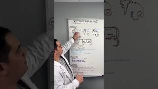 Ischemic Stroke  Middle Cerebral Artery Stroke MCA shorts [upl. by Birch442]