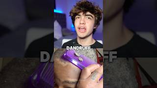 How to get rid of dandruff 😱🤝 [upl. by Donni]