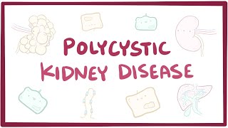 Polycystic kidney disease  causes symptoms diagnosis treatment pathology [upl. by Hoebart]