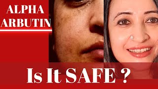 Is Alpha Arbutin Safe in Skin care and Body care Should you stop it After 3 months [upl. by Alracal147]