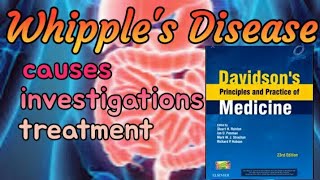 Whipples Disease made easyWhipple disease symptoms treatment prognosisUrduhindi [upl. by Nod]