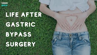 Life After Gastric Bypass Surgery [upl. by Chien]