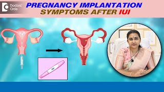 4 Signs of IMPLANTATION after IUI  Pregnancy Implantation Symptoms DrSneha ShettyDoctors Circle [upl. by Eitak]