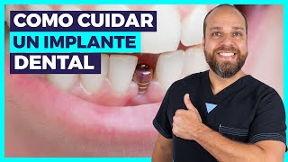 ¿Cómo CUIDAR mis IMPLANTES Dentales 🤔 Todas tus PREGUNTAS Respondidas ⚡ [upl. by Bernelle]