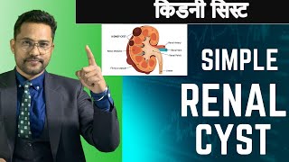 Simple Renal cyst  POLYCYSTIC KIDENY DISEASE IN HINDI [upl. by Kenward]