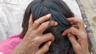 scalp checking ASMR  Heavy lice And nits Removal by hands  Head Checking  Mousaasmr830 [upl. by Zitah]