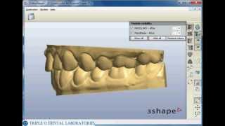 Ortho Viewer Views MP4 [upl. by Argela166]