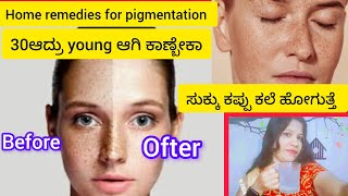 ಬಂಗಿನ ಸಮಸ್ಯೆಗೆ ಮನೆಮದ್ದುhome remedies for pigmentation and dark circleಮುಖದಲ್ಲಿಸುಕ್ಕು ಕೂಡ ಮಾಯಆಗುತ್ತೆ [upl. by Notnirt]