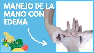 🧠 Rehabilitación de la HEMIPLEJÍA tras el ICTUS 👋 MANEJO DE LA MANO CON EDEMA [upl. by Brathwaite366]