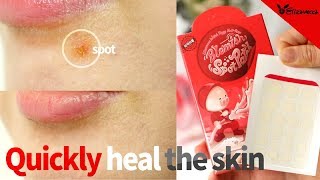 hell pore blemish spot patch of 2019 Best new skin recovery product [upl. by Rooney]