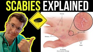 Skin Lesions with defination [upl. by Dnomzed]