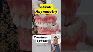 Facial Asymmetry Treatment What Are Your Options dentallan dentist shorts [upl. by Ahsiugal998]