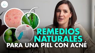 🔴 REMEDIOS CASEROS para ELIMINAR el ACNE ¿Mito o realidad drapilarochoa  Dermatologa [upl. by Nnaassilem]