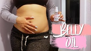 HOW I AM TRYING TO PREVENT STRETCH MARKS [upl. by Nirel]