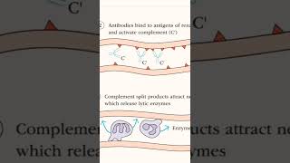 hyperacute rejection of kidney graft [upl. by Itsuj]