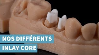 Nos différents inlay core  répondez à toutes les contraintes esthétiques amp mécaniques [upl. by Joliet]