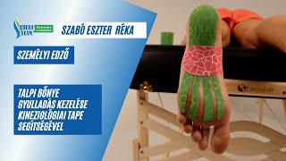 Kinesio tape technikák – Plantar fasciitis talpi bőnye gyulladás kezelése kinesiotape theraband [upl. by Asusej314]