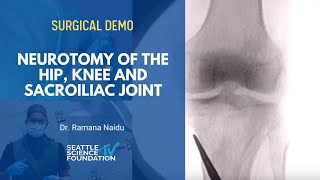 Neurotomy of the Hip Knee and Sacroiliac Joint  Ramana Naidu MD [upl. by Gredel]