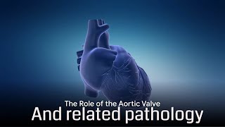 Aortic Stenosis Everything You Need To Know For The Usmle [upl. by Eyatnod340]