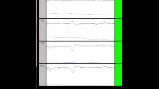 BrainAvatar Muse EEG [upl. by Seebeck]