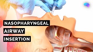 Nasopharyngeal Airway NPA Insertion  ABCDE Emergency  OSCE Guide  UKMLA  CPSA [upl. by Airol]