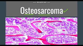 Osteosarcoma GeneralMorphology SubtypesClinical features [upl. by Rodama]