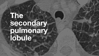 The Secondary Pulmonary Lobule [upl. by Etiuqal7]