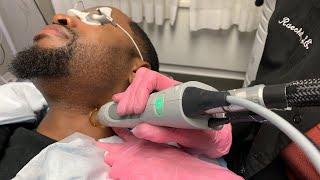 Candela Laser  Hair Removal with Safaree  New York NY  Dr Jason Emer [upl. by Ayyn]