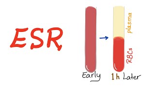 Erythrocyte Sedimentation Rate ESR What Does This Lab Test Really Mean [upl. by Miche947]