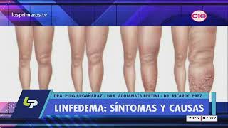 Linfedema qué es Medidas para prevenir y tratar el linfedema [upl. by Pence]