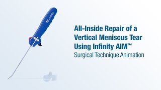 AllInside Repair of Vertical Meniscus Tear Using Infinity AIM™  CONMED Animation [upl. by Aksoyn631]