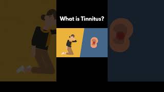 What is Tinnitus [upl. by Nylarahs400]