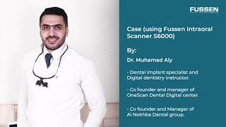 Case Using Fussen Intraoral Scanner S6000 By Dr Muhamad Ali [upl. by Aidnac]