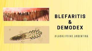 Blefaritis y Demodex liftingdepestañas lashlifting [upl. by Elocin]