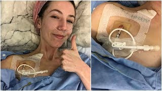 ♡ Getting a Hickman Line amp Starting TPN 251018  Amys Life ♡ [upl. by Saisoj]