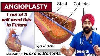 Angioplasty amp Stenting Explained  Opening Blocked blood supply  DrEducation Hindi eng [upl. by Enomad]