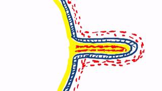 chorionic villi by dr sameh ghazy [upl. by Manvel]