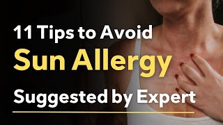 11 Tips to Avoid Sun Allergy  Sun Allergy Natural Treatment [upl. by Lipscomb]