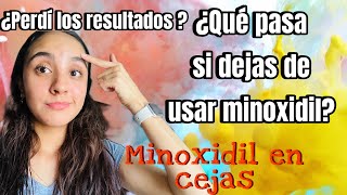 ¿Se mantienen los resultados si dejas de usar MINOXIDIL  EFECTOS SECUNDARIOS cejas y entradas [upl. by Kingsly]