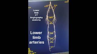 Lower limb arteries lower limb ct angiography anatomy [upl. by Stuppy]