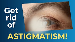 Discover How to Fix Astigmatism with Simple Eye Exercises [upl. by Snave]