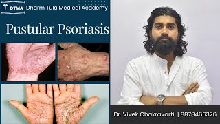 Pustular psoriasis  Psoriasis  Skin Disease  Skin psoriasis psoriasiscure psoriasissolution [upl. by Erdnoed720]