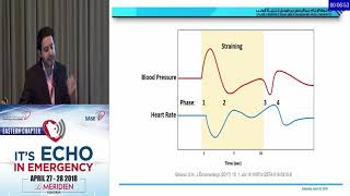 Role of echocardiography in paradoxical thromboembolism [upl. by Litta]