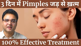 Pimples को बोलो अलविदा  4 Simple Steps To Remove Pimples amp Get Clear Spotless Skin Naturally [upl. by Hairim494]