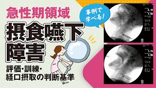 録画配信 17459『急性期領域における摂食嚥下障害の評価・訓練・経口摂取の進め方とポイント』開催済 [upl. by Heppman]